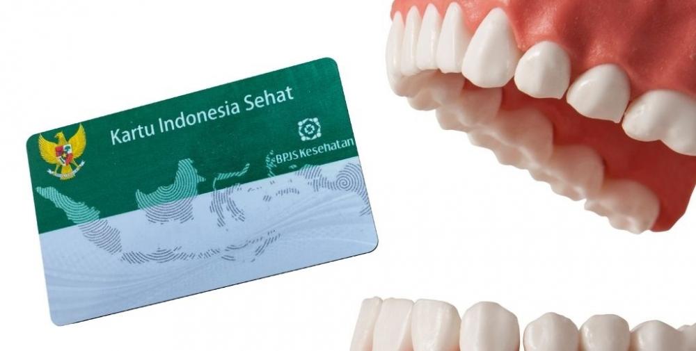 Pakai BPJS Kesehatan, Benarkah Bikin Gigi Palsu Gratis atau Hanya Dapat Subsidi?