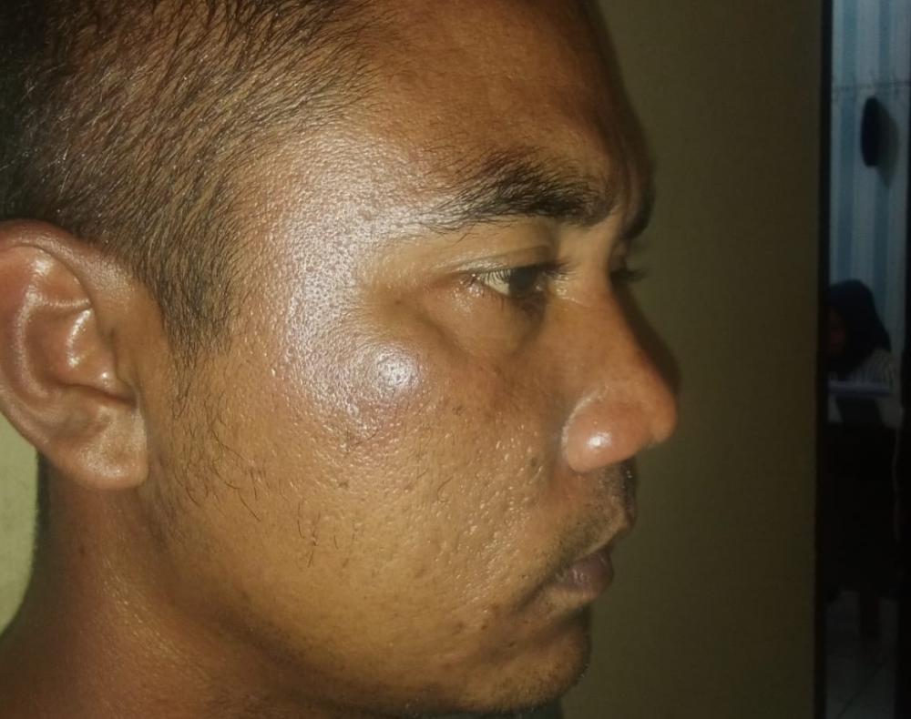 Pengusaha Batu Kapur di Baturaja Diduga Aniaya Sopir Truk, Korban Alami Lebam di Wajah