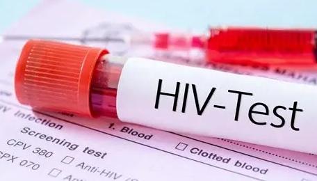Waduh! Dinkes Sumsel Temukan 537 Kasus Baru HIV, Palembang Tertinggi