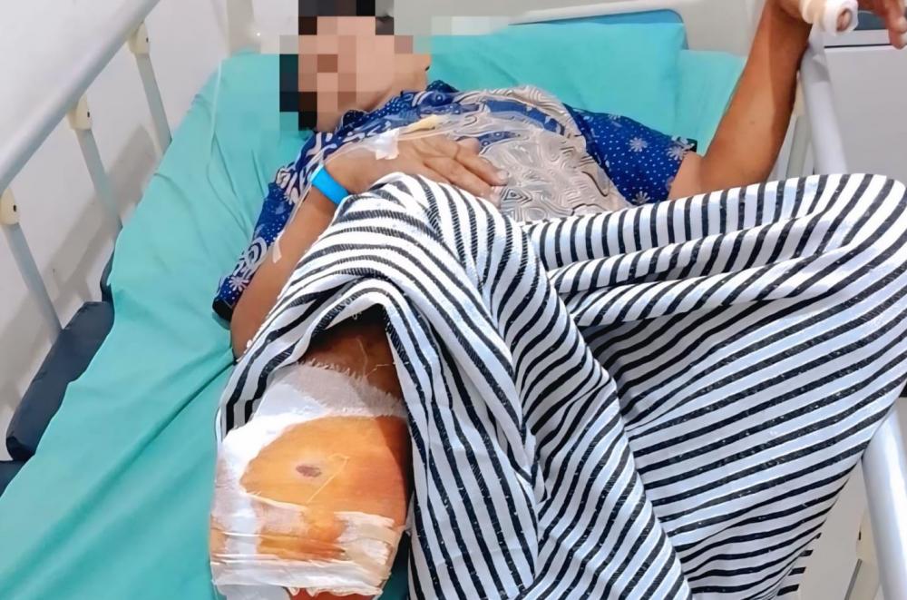 Warga OKU Diserang Beruang Saat Menyadap Karet, Polisi Imbau Tingkatkan Kewaspadaan